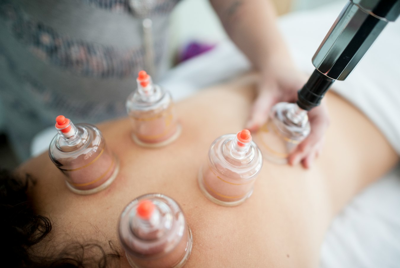 Terapis melakukan Quassa atau kerik tradisional dengan cangkir vakum di punggung pelanggan untuk melancarkan peredaran darah di RX Relaxology
